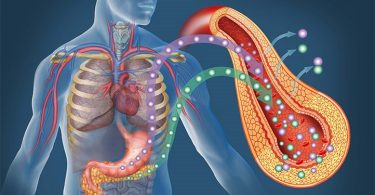 Cómo prevenir la diabetes tipo 2 desde la medicina funcional