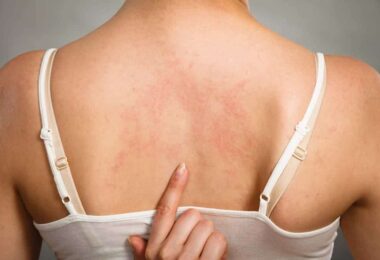 Cómo afecta la hepatitis C nuestro cuerpo