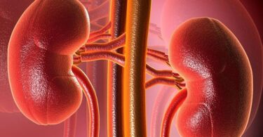 La dieta y el desarrollo de la enfermedad renal crónica