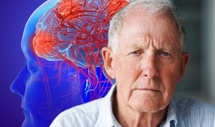 Medicamentos que causa demencia y pérdida de memoria
