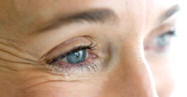 Arrugas en ojos - licopeno efectos prevenir deterioro ppor la edad