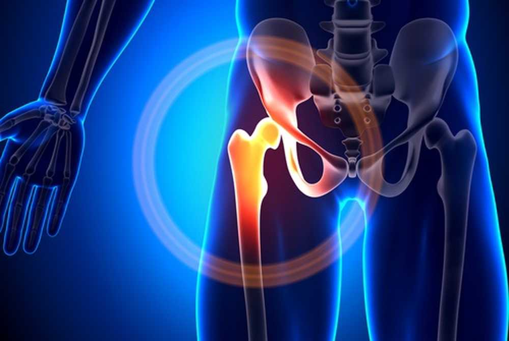 Causas del dolor en la articulación de la cadera