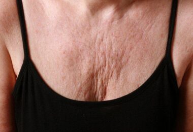 Cómo prevenir las arrugas en el pecho