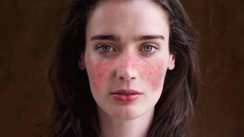 Mujer con manchas en su rostro