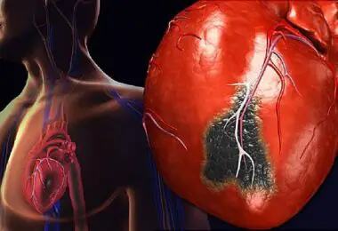 Signos de problemas cardíacos que permanecen ocultos
