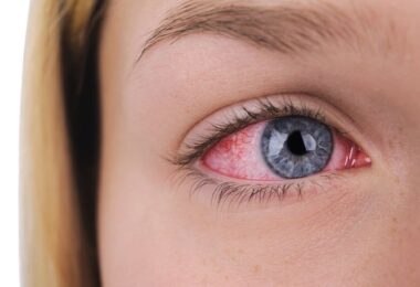 Ojos secos y con enrojecimiento