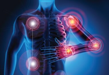 Yoga para artritis reumatoide