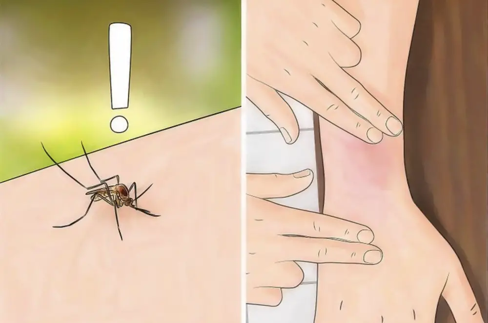 Por qué te pican los mosquitos