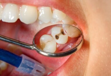 Problemas dentales por dormir con la boca abierta