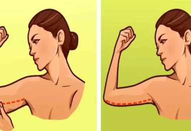 Ejercicios para eliminar la flacidez de los brazos
