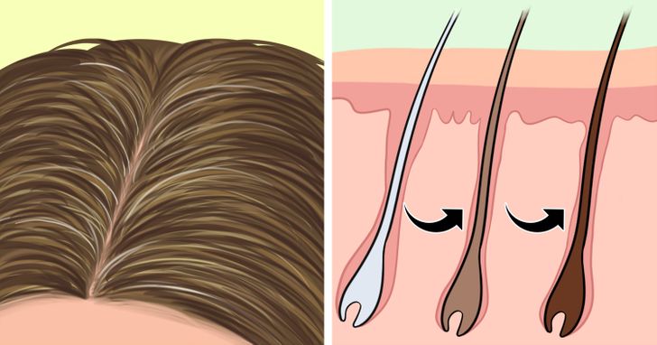 ilustración de pelo con canas folículos