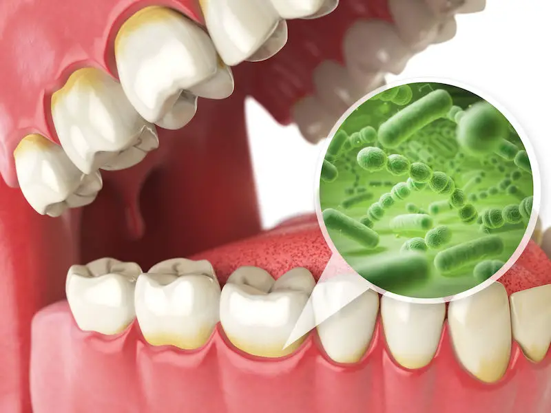 Hongos y bacterias en la boca