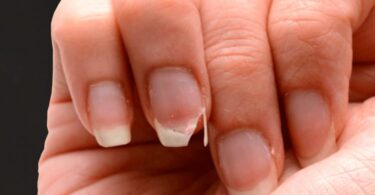 Consigue endurecer las uñas con estos remedios caseros