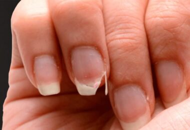Consigue endurecer las uñas con estos remedios caseros