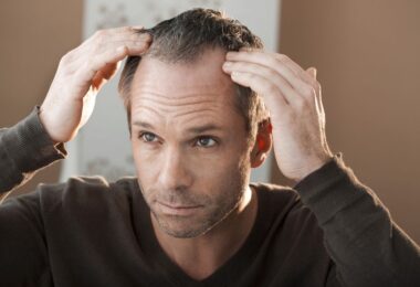 Primeros signos de alopecia