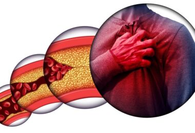 Beneficios de la grosella negra para reducir el colesterol