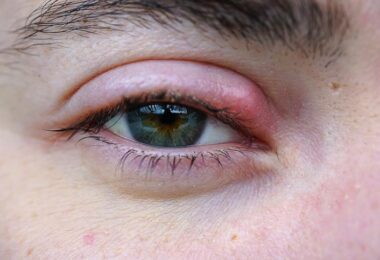 Inflamación del párpado y los problemas de salud que puede indicar