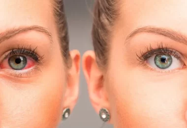 Problemas de salud que aparecen en los ojos