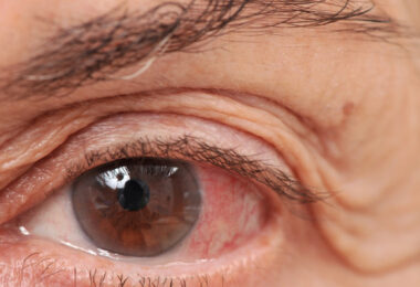 Señales de riesgo de glaucoma