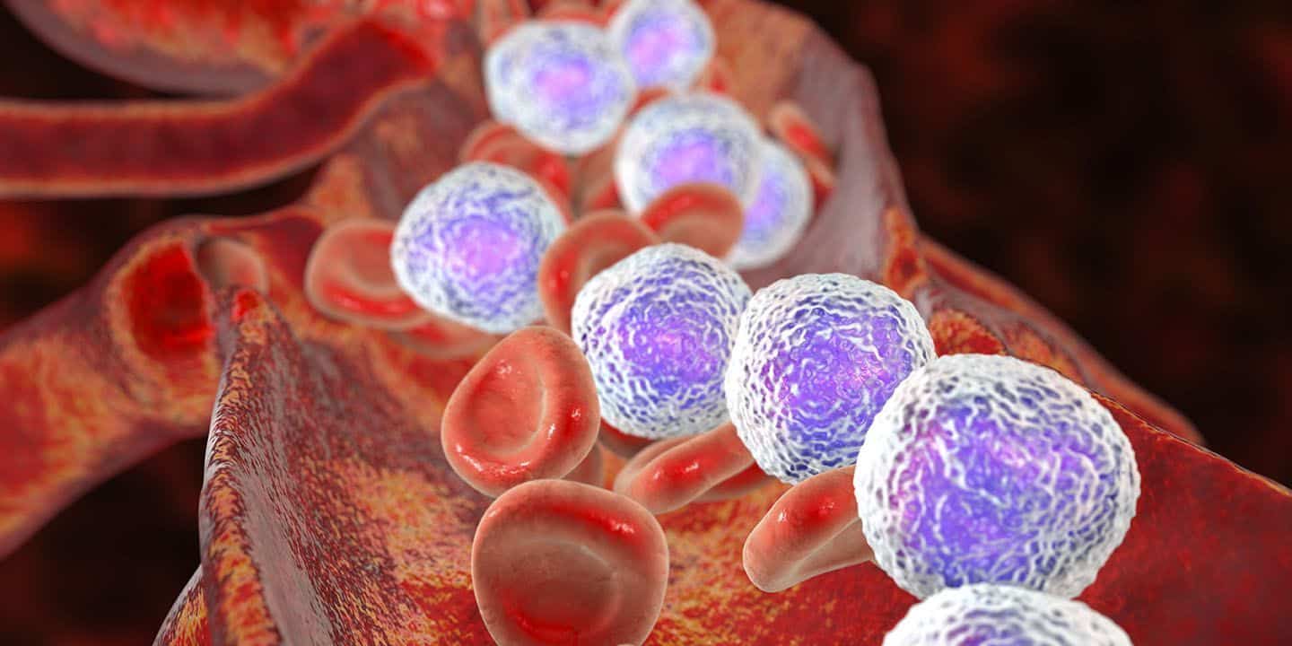 Primeros signos de leucemia que deberías conocer