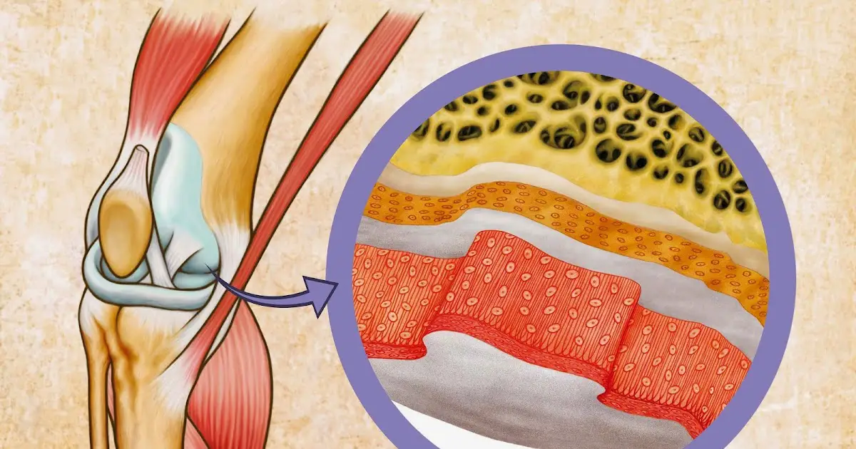 Nutriente para mejorar el cartílago de la rodilla