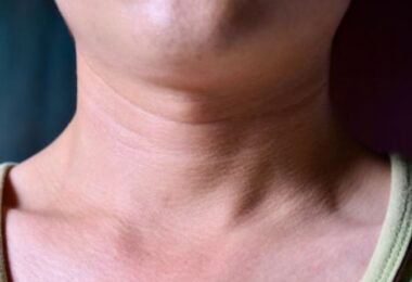 Cómo evitar las arrugas del cuello con este ingrediente casero