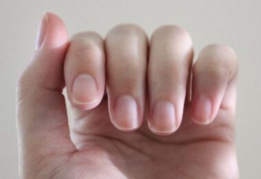 Cambios en las uñas reflejan problemas renales