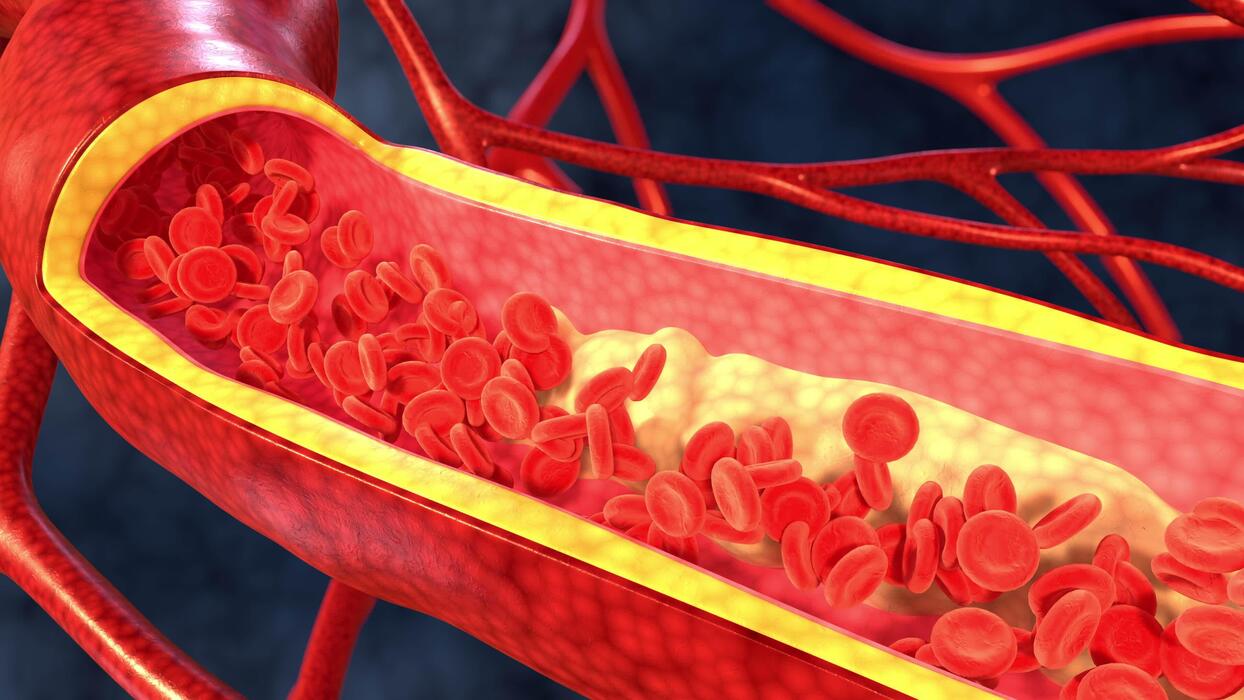 Esta hierba es la mejor solución para mantener tus arterias limpias y tu salud cardiovascular óptima