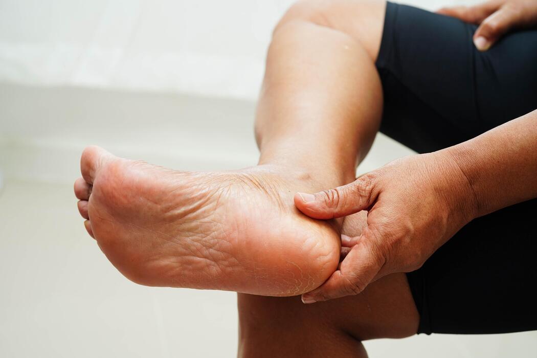 Los 7 mejores nutrientes para reducir la hinchazón en pies y piernas